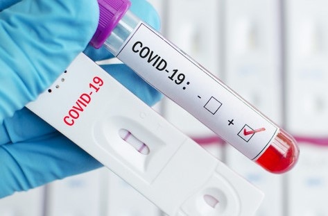 1176 са новите случаи на коронавируса у нас за последното